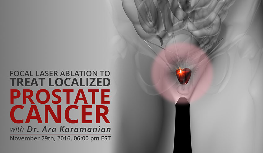 Focal Laser Ablation in Treatment of Localized Prostate Cancer – A Developing Therapeutic Option